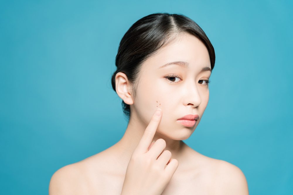 顔のほくろを気にしている女性