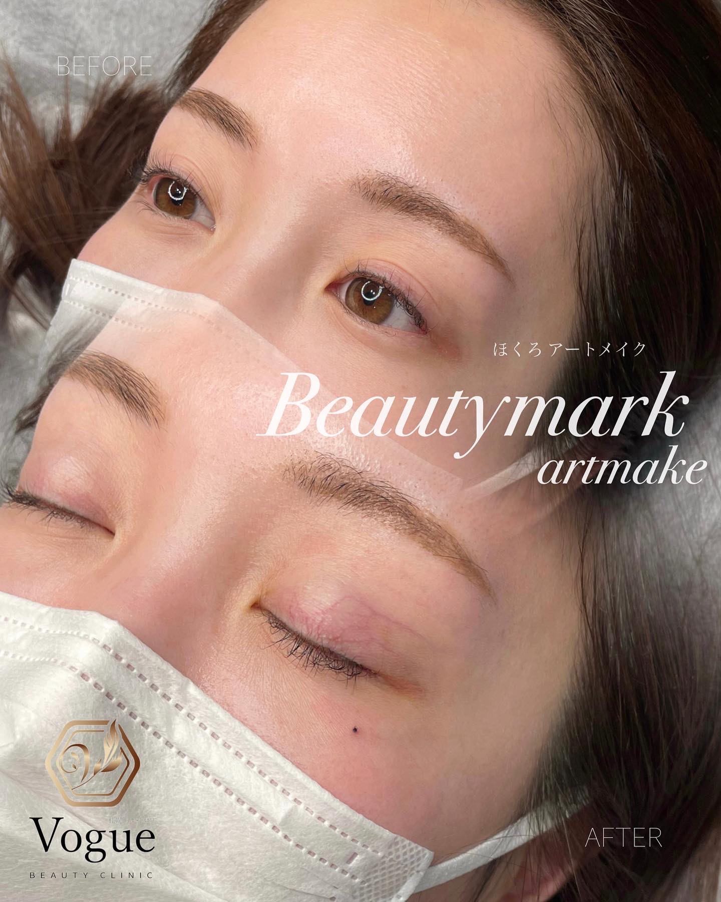 ほくろアートメイク(目元、目の下)