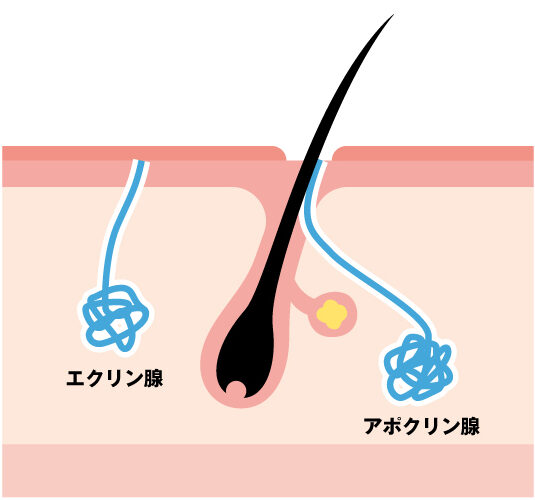 どうしてワキガ（腋臭）が起こるのか
