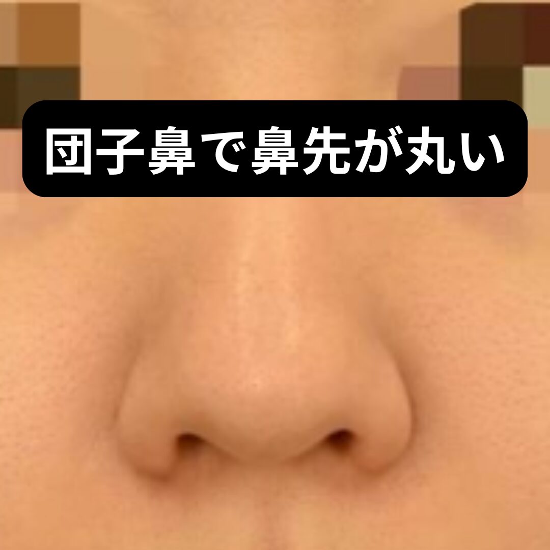 鼻 が でかい